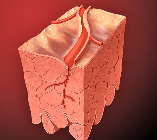 Srčana arterija